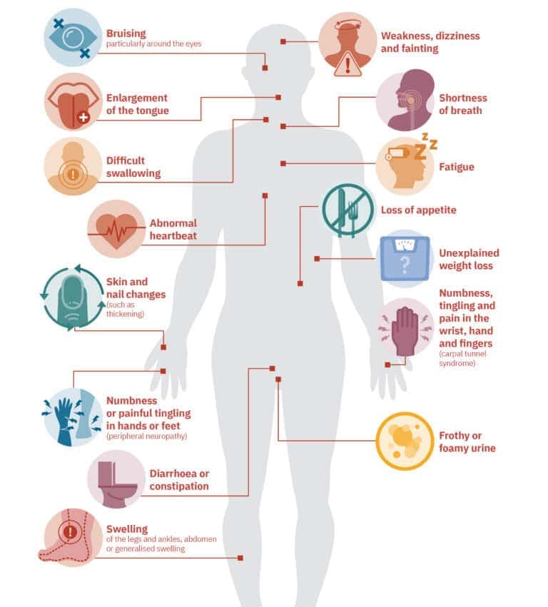 Symptoms of AL amyloidosis - Myeloma Patients Europe